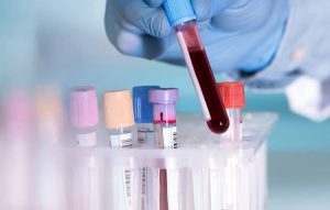 Xét nghiệm máu có được hưởng bảo hiểm y tế không?